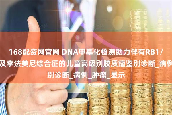 168配资网官网 DNA甲基化检测助力伴有RB1/SETD2变异及李法美尼综合征的儿童高级别胶质瘤鉴别诊断_病例_肿瘤_显示